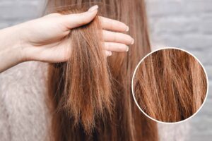 23. Damaged Hair Treatment: Comprehensive Guide to Revitalize Your Locks